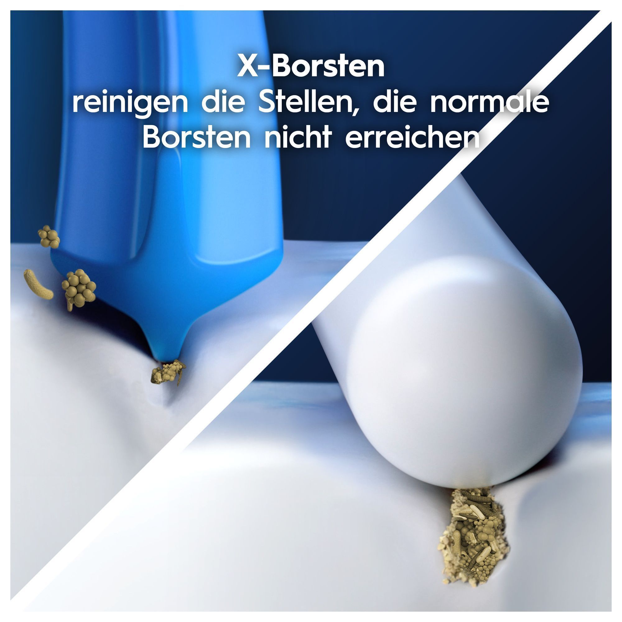 Oral-B X-Borsten reinigen Stellen, die normale Borsten nicht erreichen, demonstriert durch den Vergleich zweier Borsten in der Anwendung.