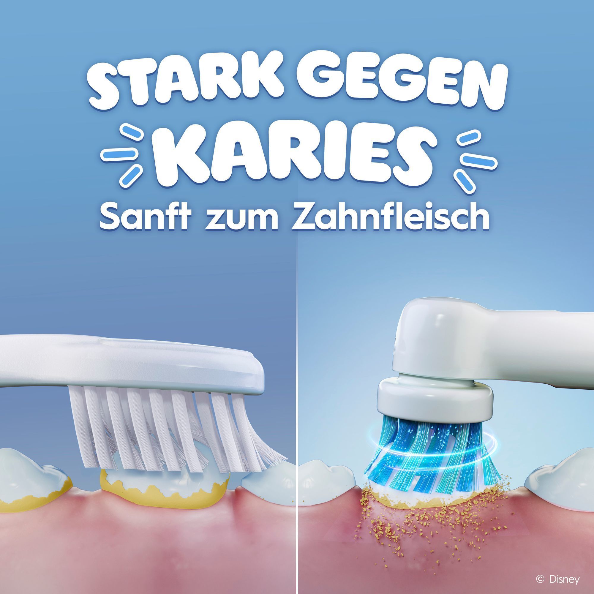 "Vergleich einer Handzahnbürste und einer elektrischen Zahnbürste mit dem Text: STARK GEGEN
KARIES, sanft zum Zahnfleisch"