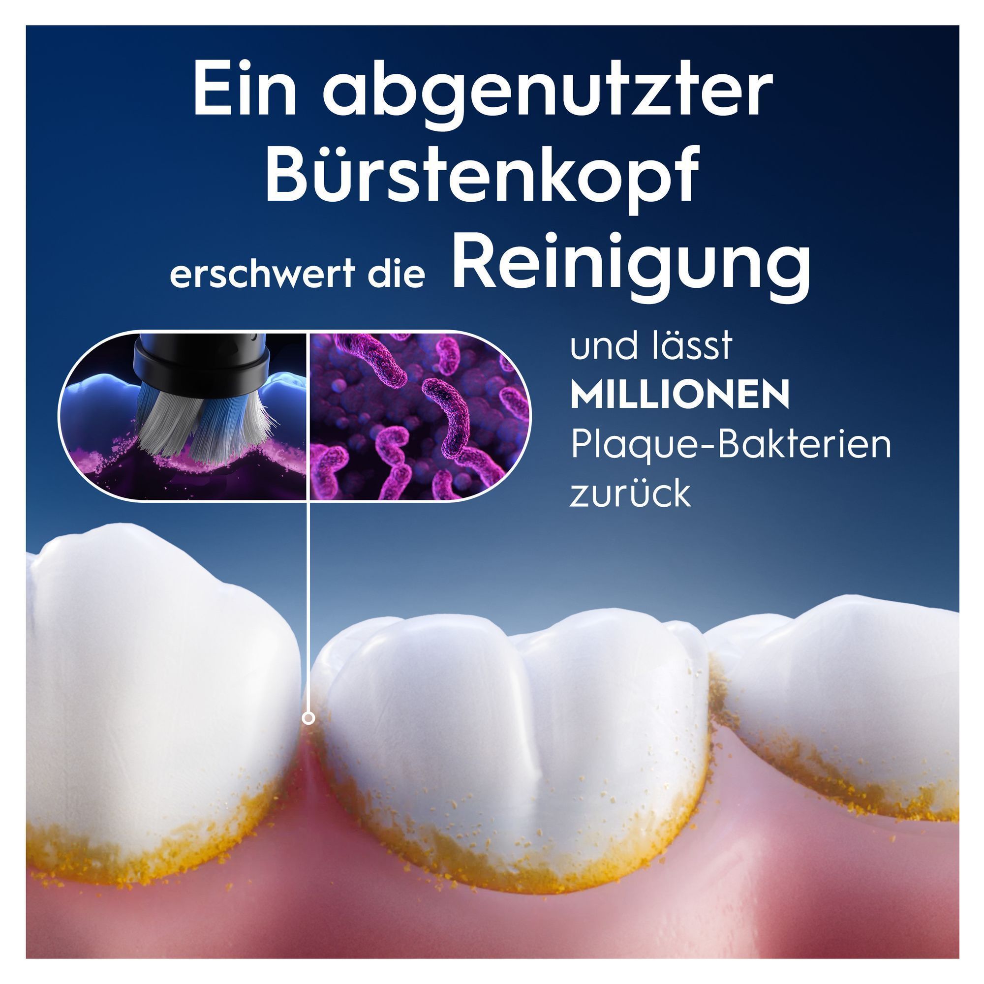Oral-B: Ein abgenutzter Bürstenkopf erschwert die Reinigung und lässt Millionen Plaque-Bakterien zurück.