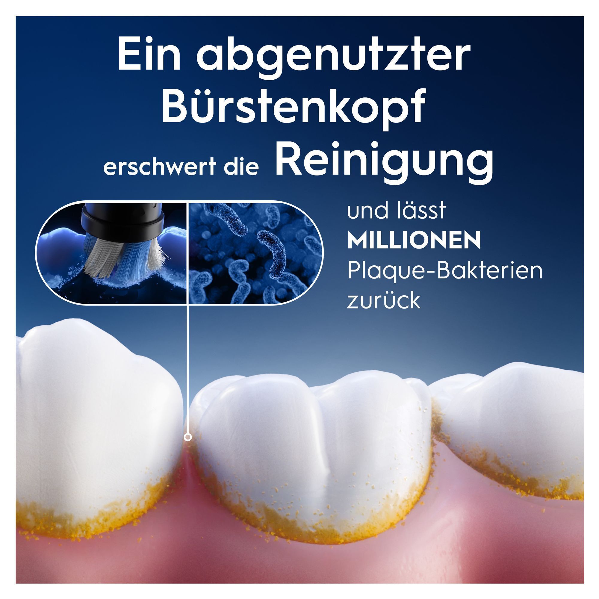 Oral-B: Ein abgenutzter Bürstenkopf erschwert die Reinigung und lässt Millionen Plaque-Bakterien zurück, wie auf den Zähnen sichtbar.