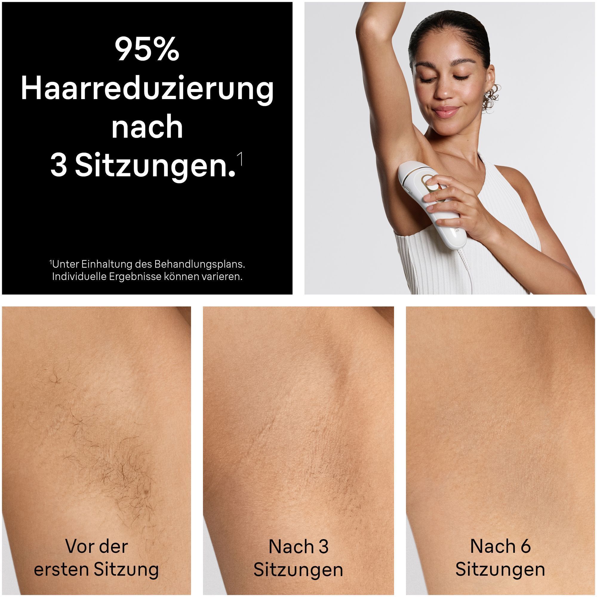 1. Eine Frau verwendet den Braun Silk·expert Pro 5 an ihrer Achsel. 2. Vorher- und Nachher-Bilder der Achsel, die die Haarreduktion zeigen.