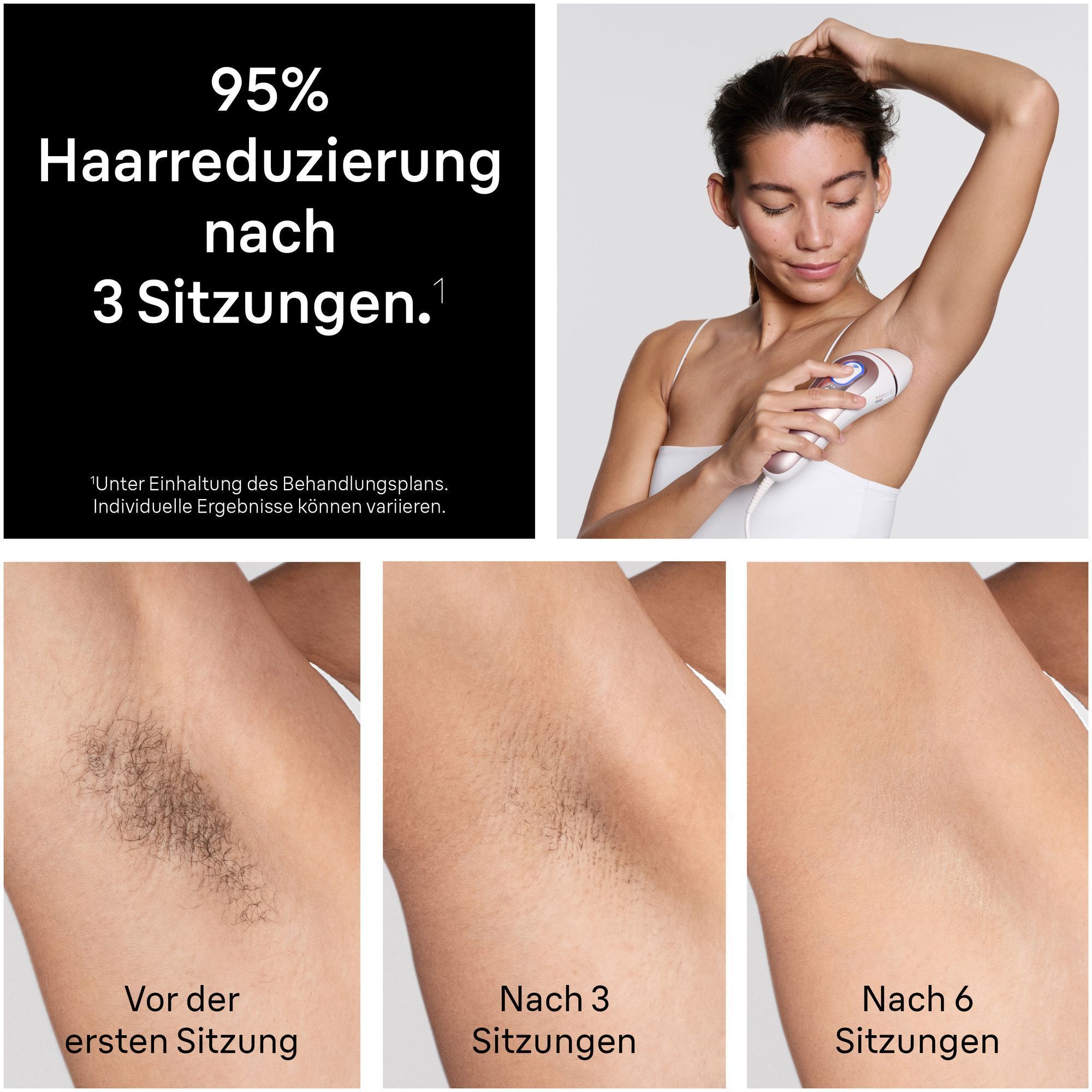 1.Nahaufnahme des neuen Smart Flex Aufsatzes.  2.Eine Frau benutzt den neuen Aufsatz an ihrem Knie.  3.Verschiedene Braun Skin iÂ·expert AufsÃ¤tze.