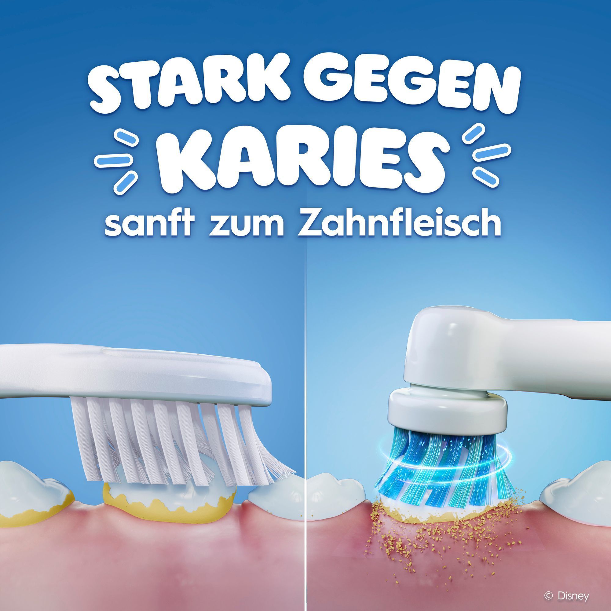 Vergleich einer Handzahnbürste ggü. einer elektrischen Zahnbürste. Die elektrische Zahnbürste ist stark gegen Karies und sanft zum Zahnfleisch