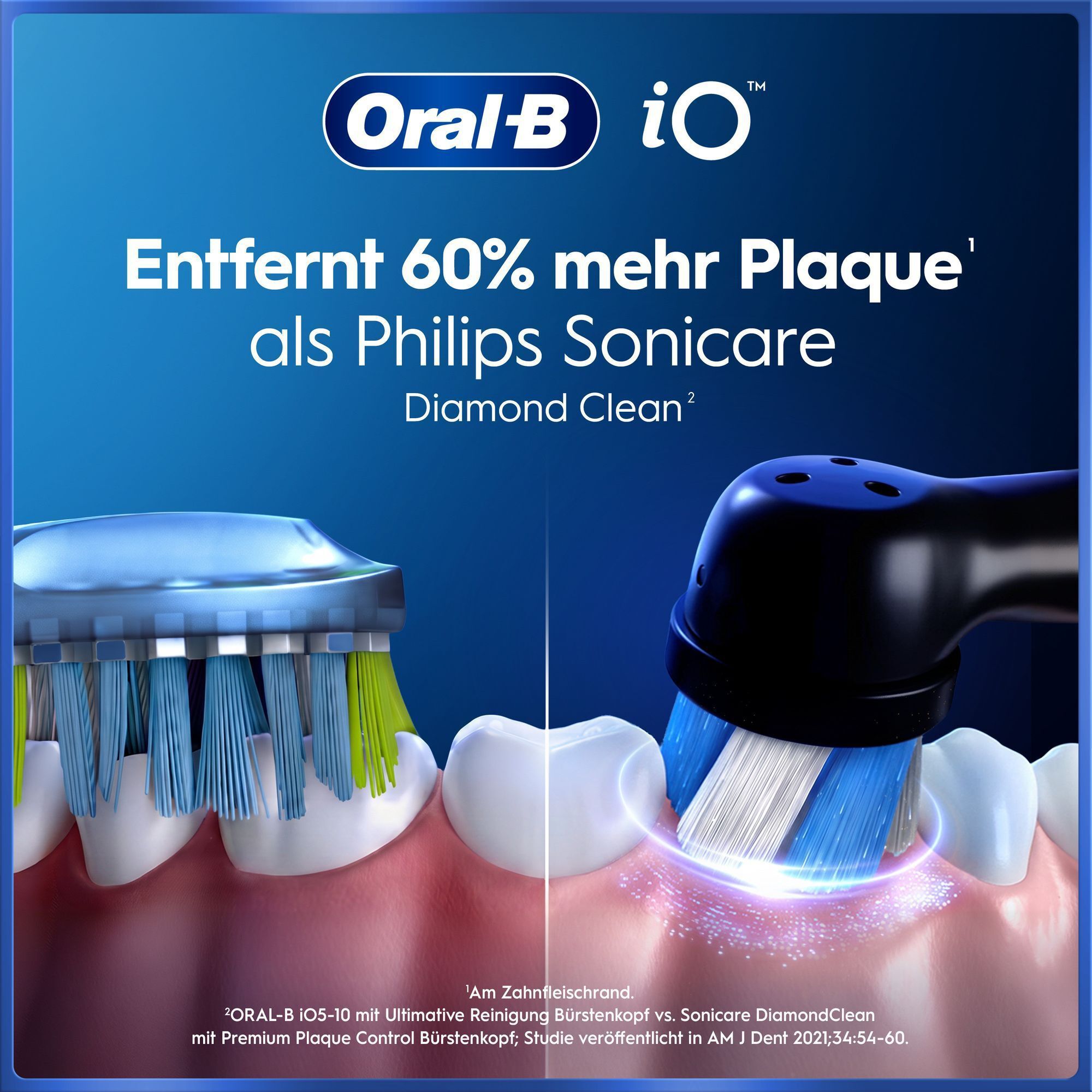 45% bessere Zahnfleischgesundheit mit Oral-B iO vs. Schallzahnbürste.