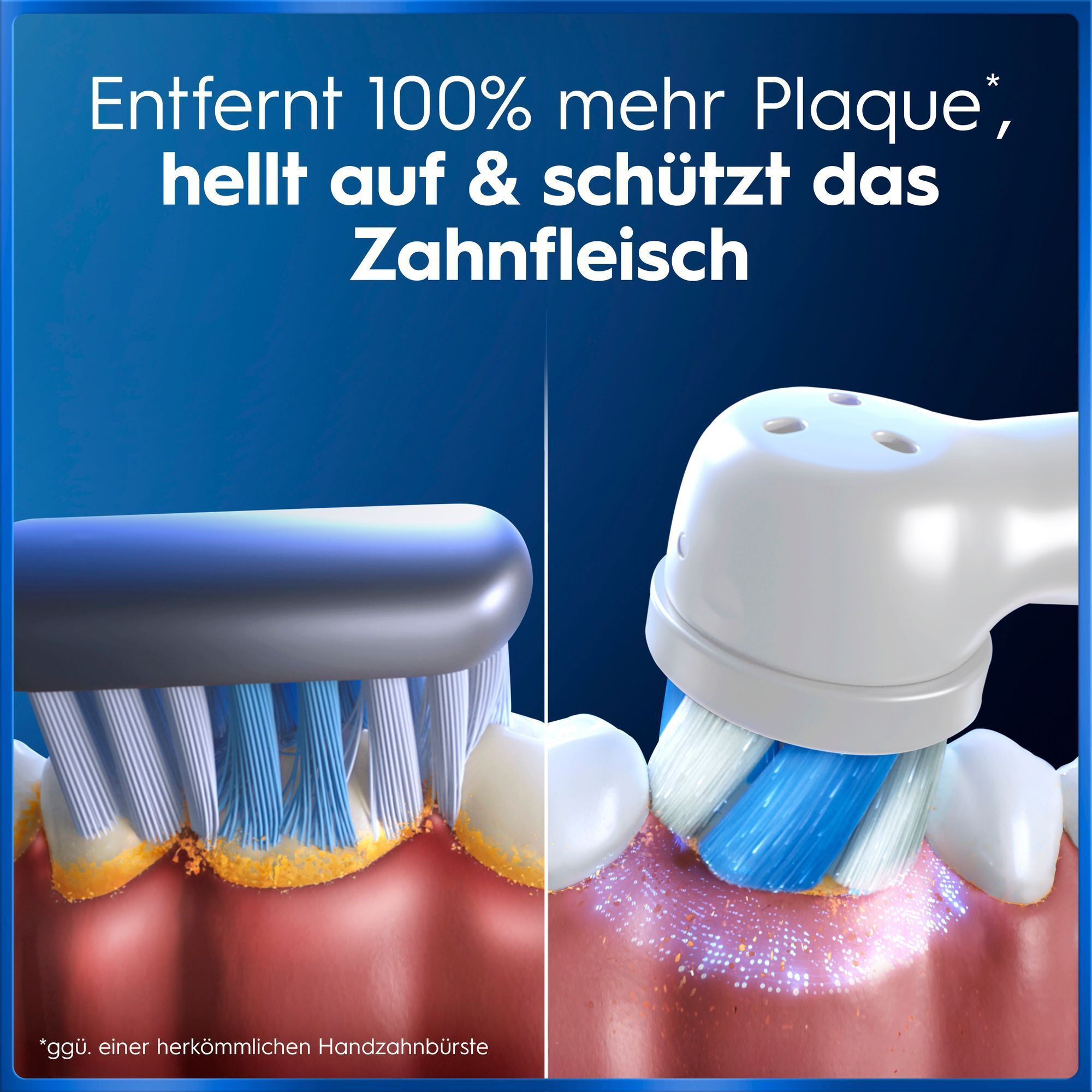 E-Zahnbürste entfernt mehr Plaque und schützt Zahnfleisch besser als manuelle