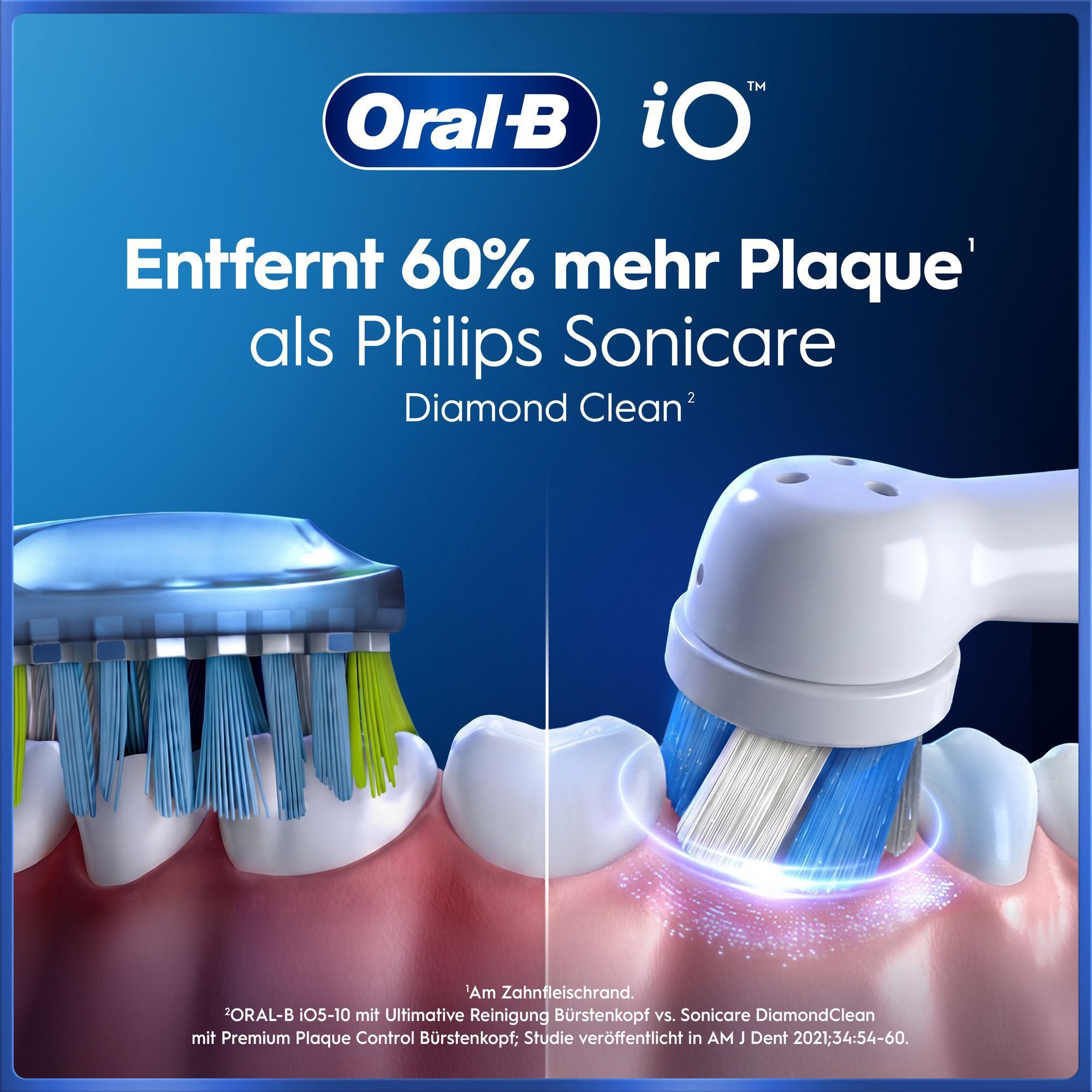 Oral-B iO: 45% bessere Zahnfleischgesundheit gegenüber Schallzahnbürsten.