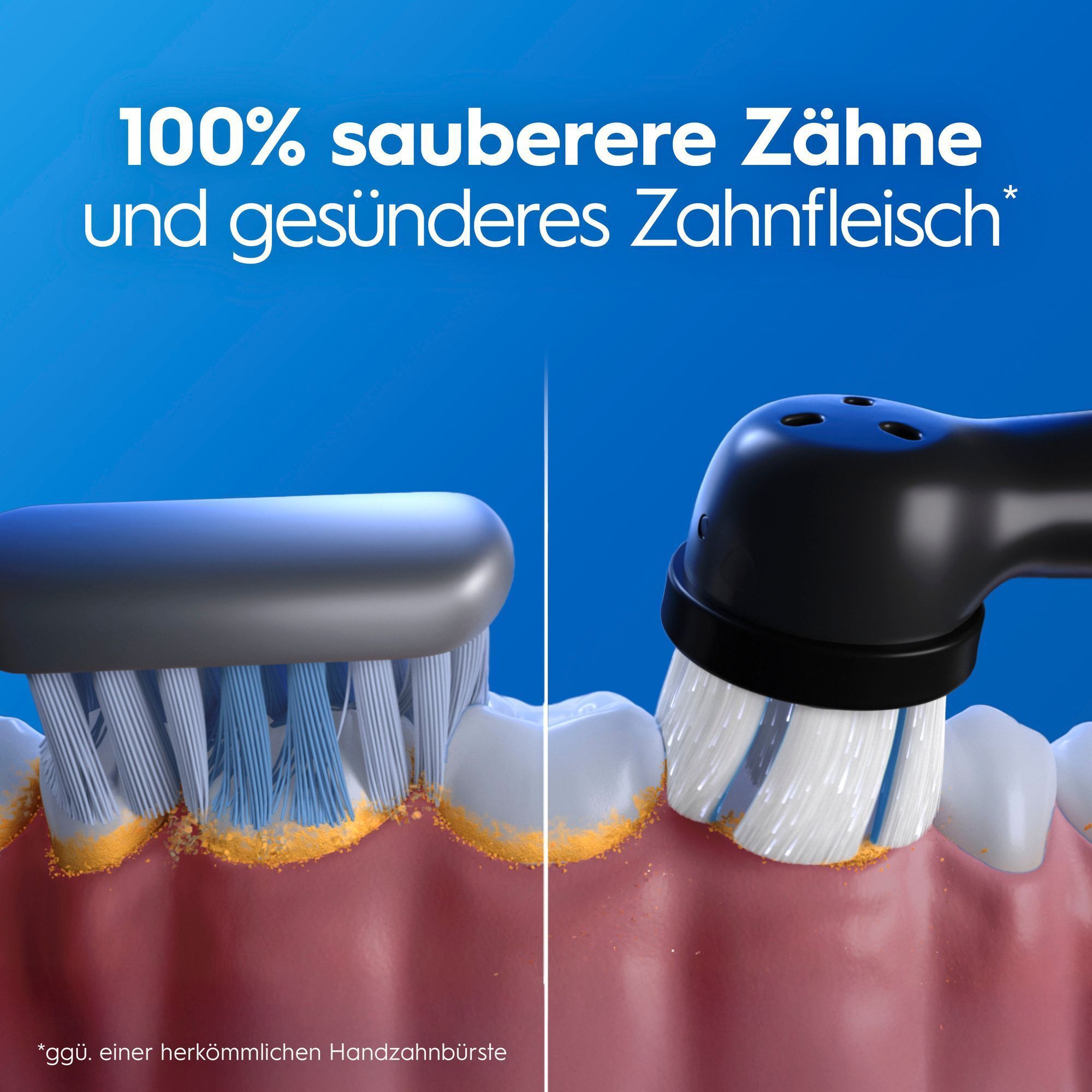 Vergleich: normale vs. elektrische Zahnbürste für sauberere Zähne und gesundes Zahnfleisch