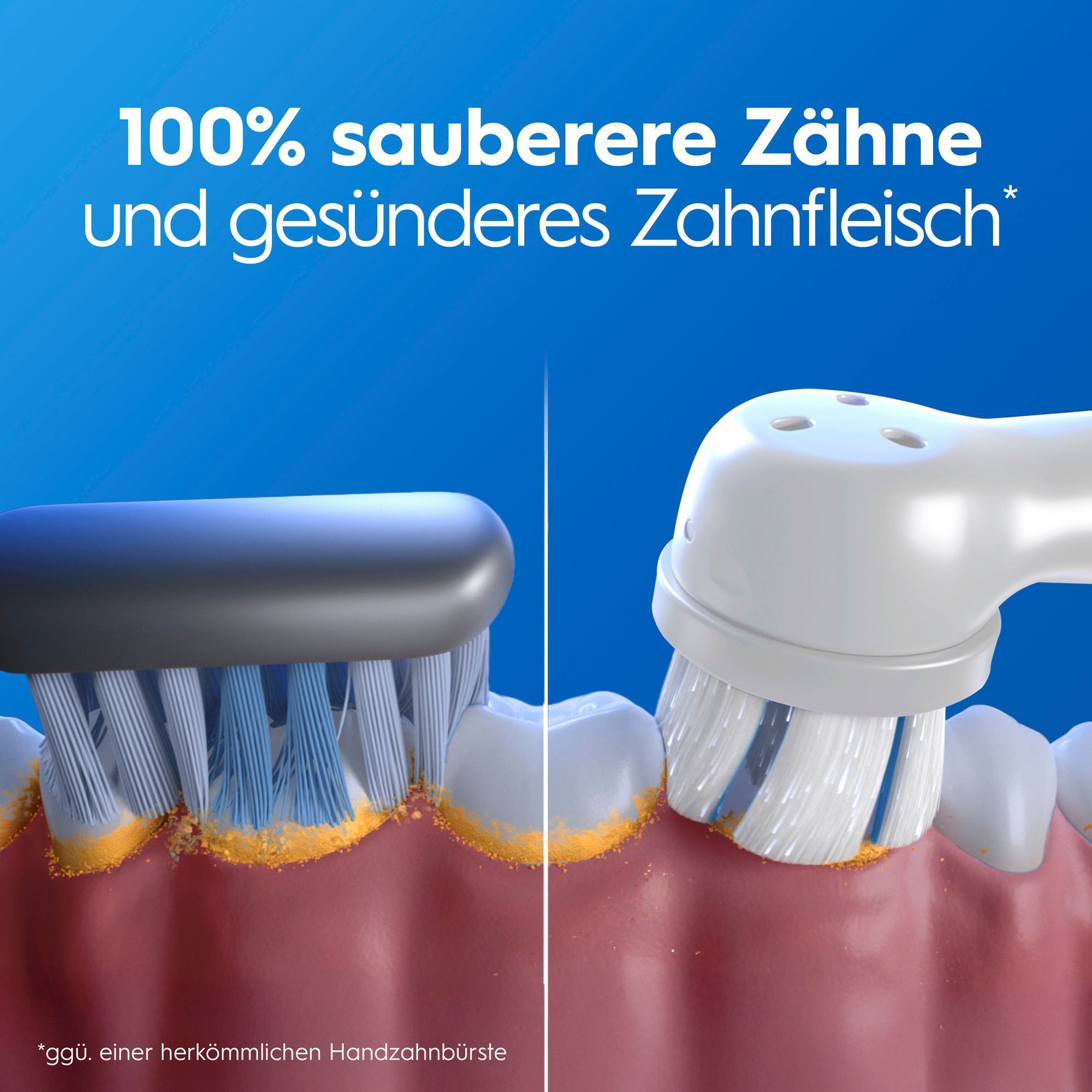 Vergleich: normale vs. elektrische Zahnbürste für sauberere Zähne und gesundes Zahnfleisch