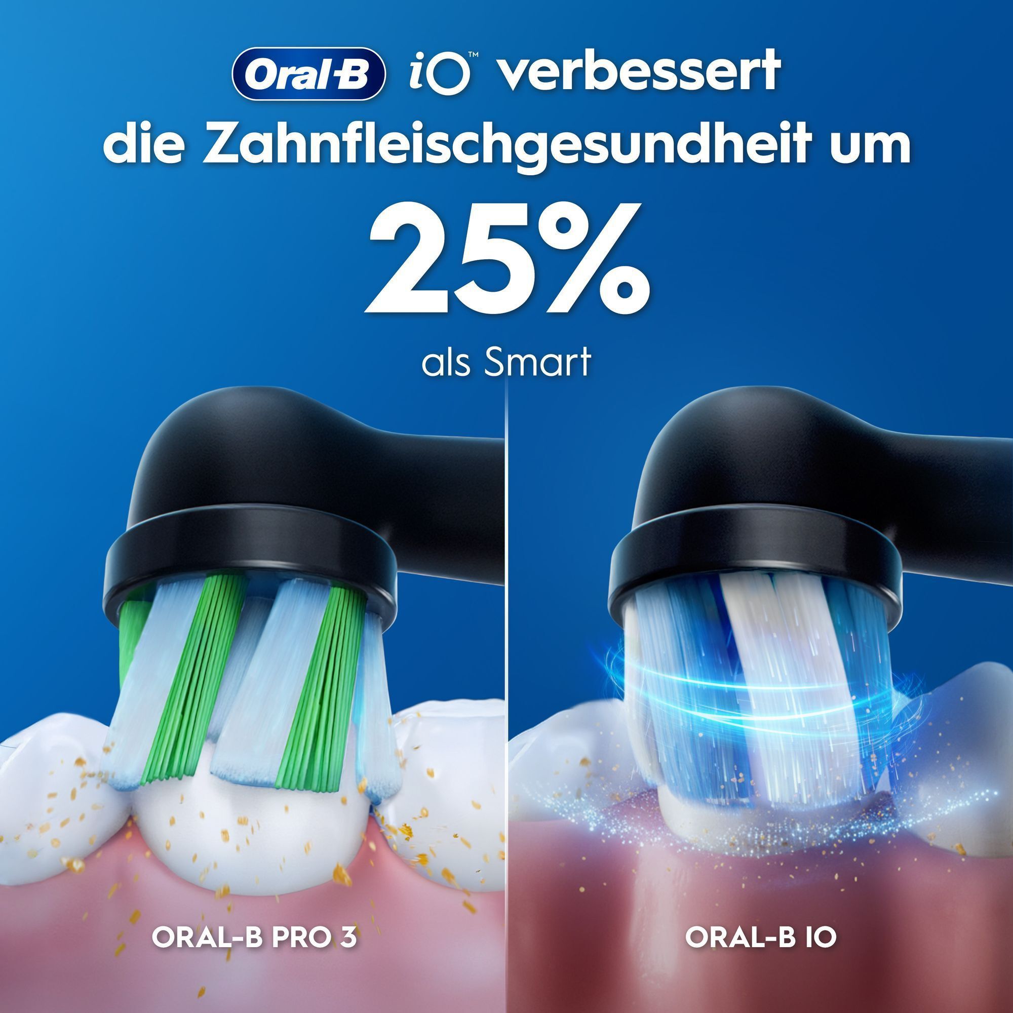 Oral-B iO verbessert Zahnfleischgesundheit um 25% gegenüber Oral-B Smart.