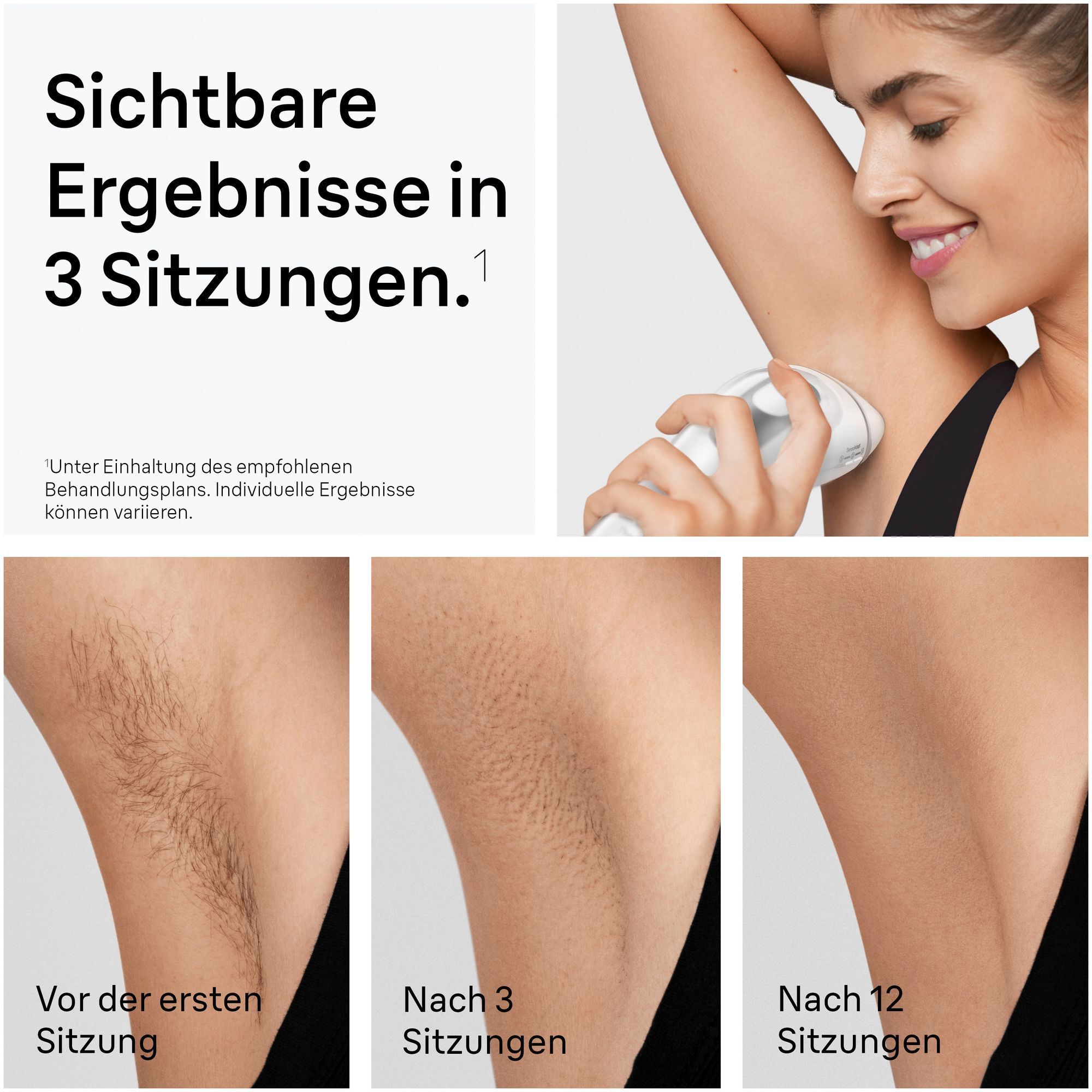 1. Eine Frau verwendet den Braun Silk·expert Pro 3 an ihrer Achsel. 2. Vorher- und Nachher-Bilder der Achsel, die die Haarreduktion nach 3 Sitzungen zeigen.