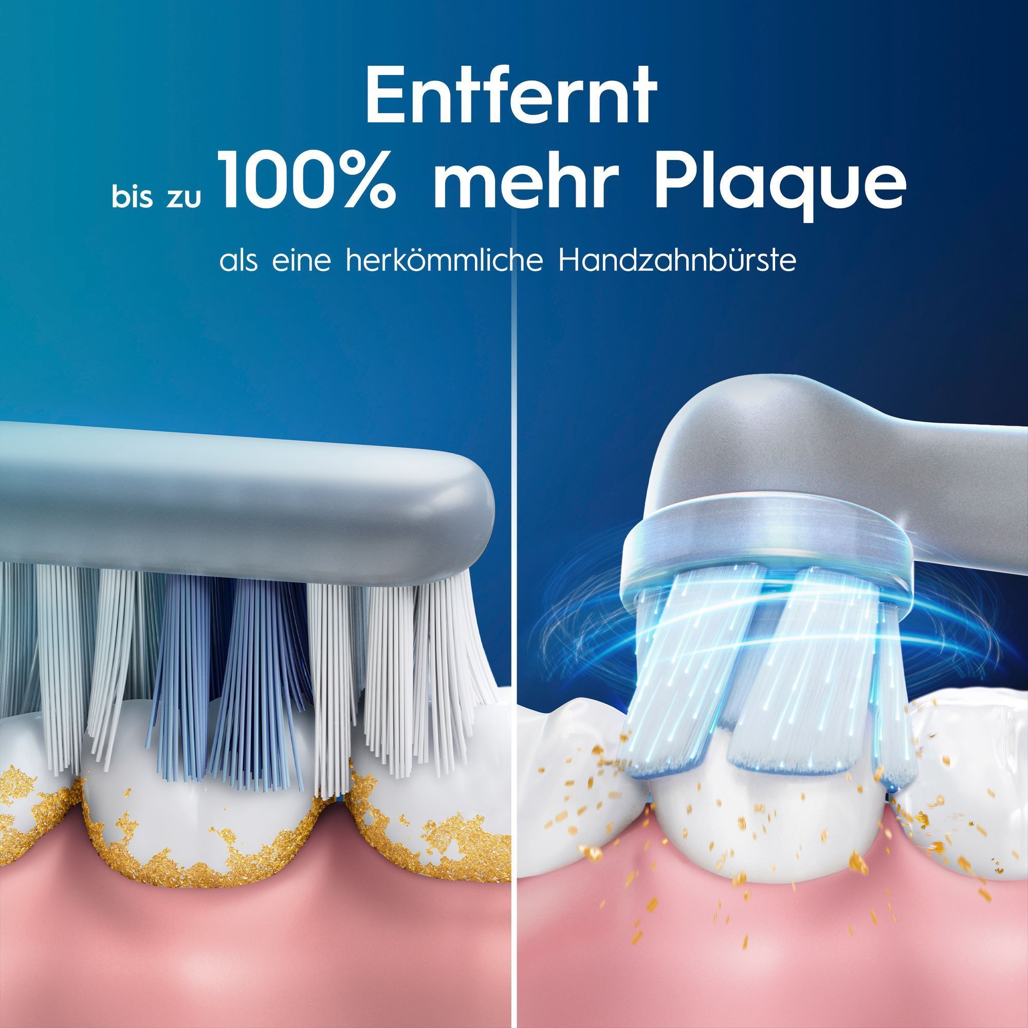 Abbildung vergleicht die Plaque-Entfernung einer HandzahnbÃ¼rste ggÃ¼. einer Oral-B elektrischen ZahnbÃ¼rste. Die Oral-B elektrische ZahnbÃ¼rste entfernt bis zu 100% mehr Plaque als eine herkÃ¶mmliche HandzahnbÃ¼rste.
